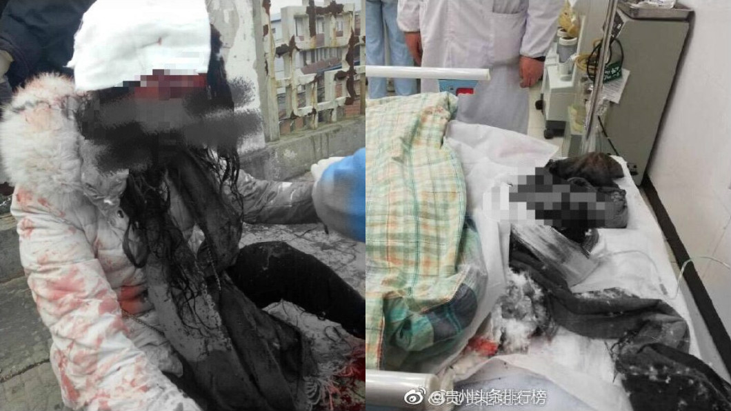 交往1個月被甩 他狂砍女友19刀成血人