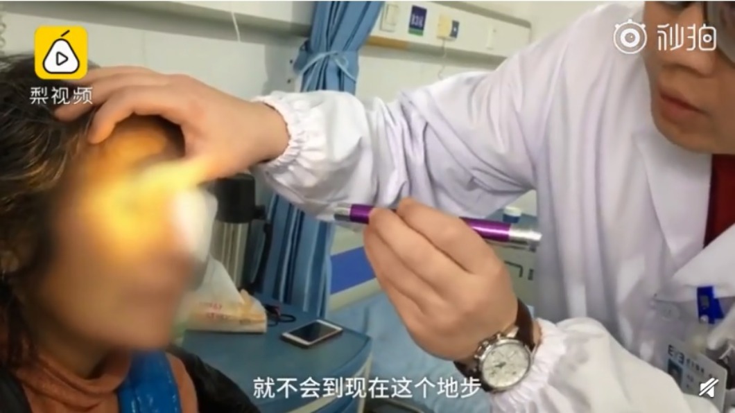 聽信偏方「花露水洗眼睛」 6旬婦角膜爛膿穿孔摘眼球
