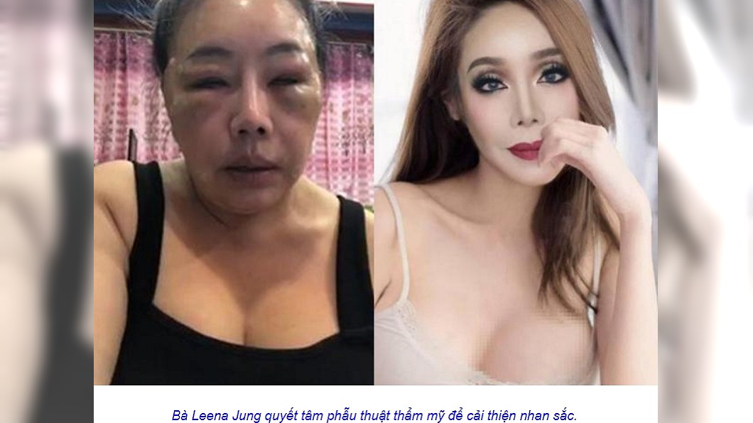 麗娜大方分享整形後的美照。圖/翻攝自Tin tức 24h