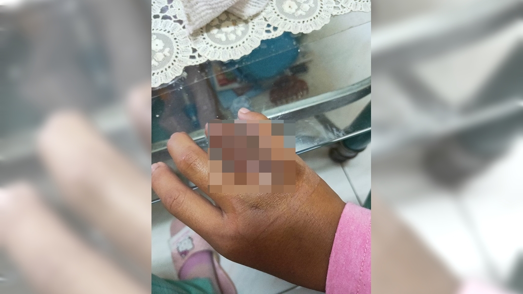只為一支鑰匙！渣男竟用鐵鎚狠砸斷女友手