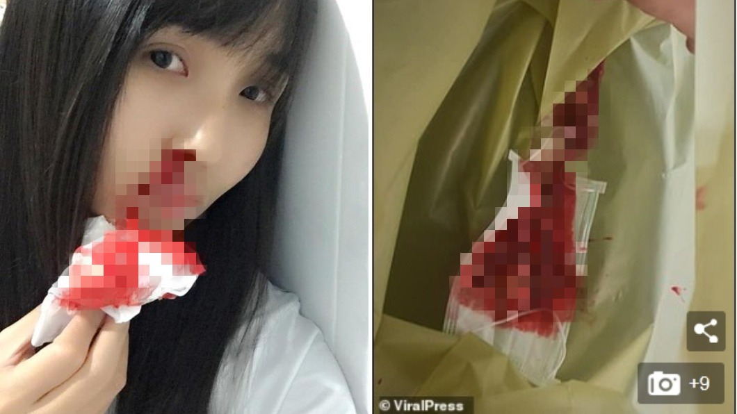 毒霧霾襲曼谷!OL鼻血爆出染紅口罩 他眼睛滲血崩潰