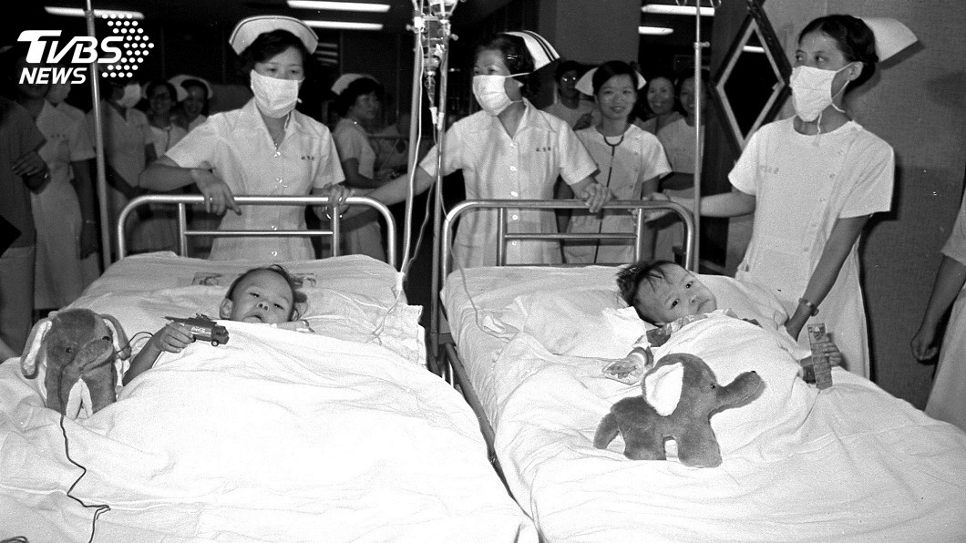 連體嬰哥哥忠仁去世　分割40年攝影展成遺憾