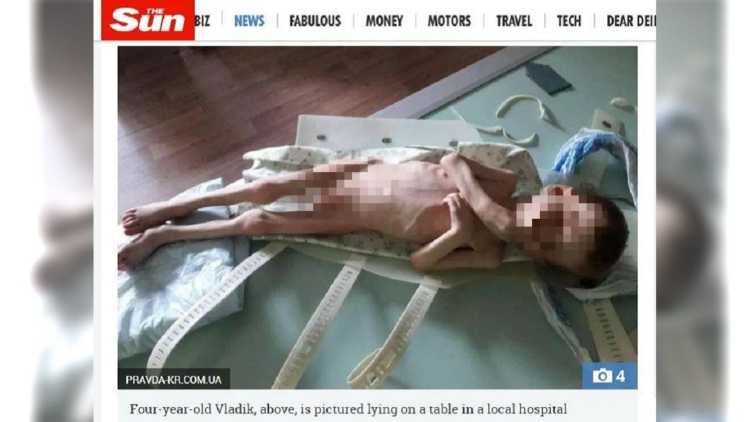 深信4歲兒是小王種　狠父把人餓到皮包骨瀕死