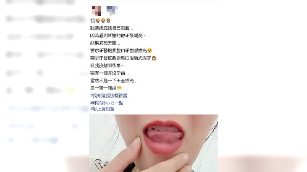 羨慕阿嬤假牙好漂亮 狂妹砸8萬「拔光整口牙」