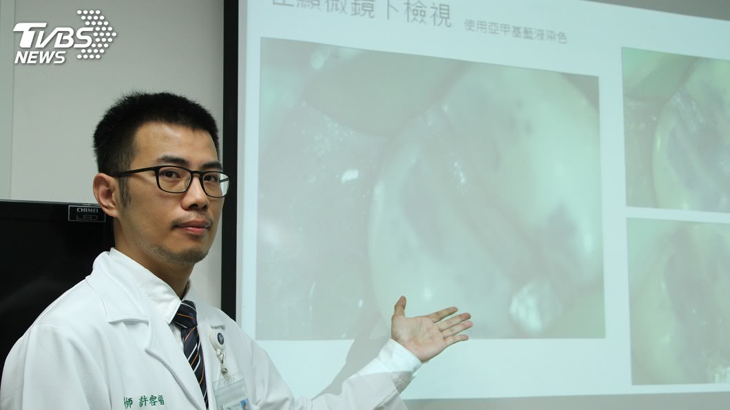 婦人牙痛反覆就醫 原來是牙齒裂了