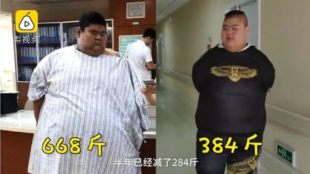 男334公斤「大陸第一胖」 半年減142公斤長2公分