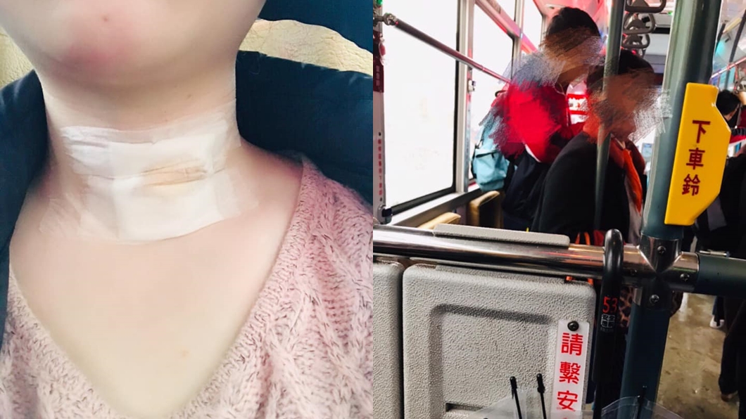 傷口痛坐博愛座被咒罵 她爆氣回嗆阿桑:妳key係啦!
