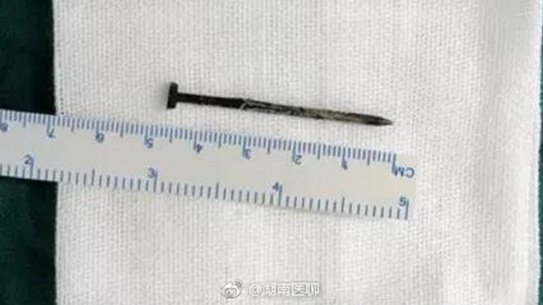 好奇心惹禍！7歲童尿道口流膿　竟是塞4.7公分鐵釘