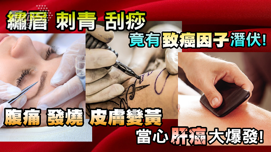 腹痛、發燒誤當腸胃炎 竟是肝炎大爆發