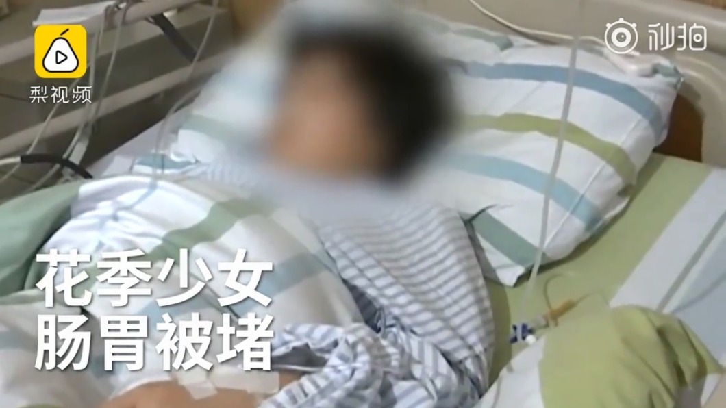 12歲女童肚痛開刀 驚見250公克黑髮!