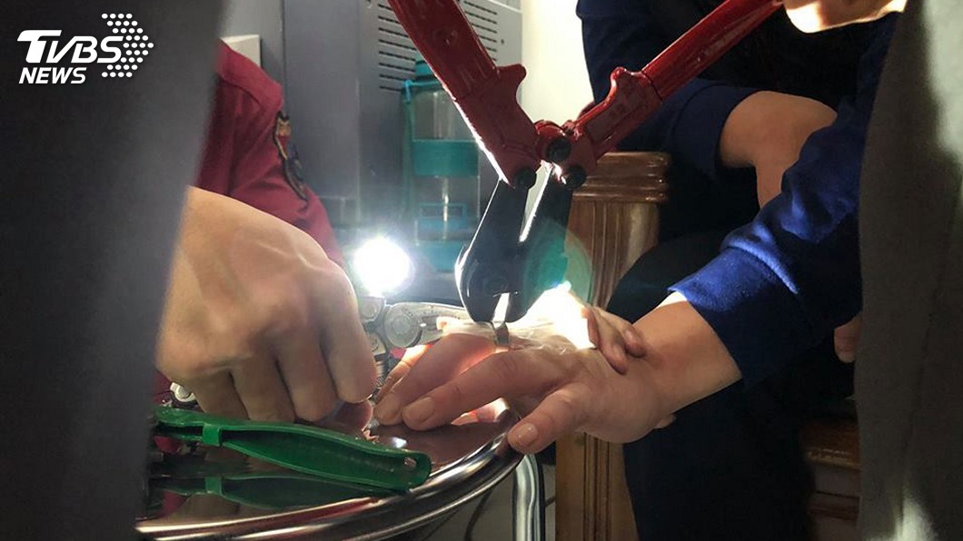 戒指卡卡腫脹疼痛 男子求助消防隊解圍