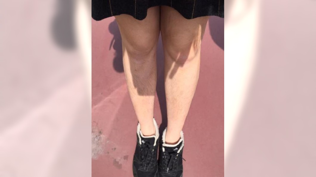 沒刮腿毛！台妹遊迪士尼遭竊笑　崩潰喊：我有罪嗎