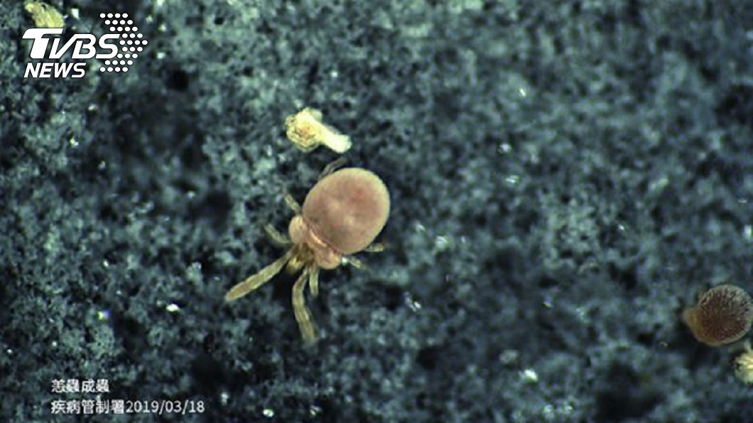 清明掃墓　小心草叢有恙蟲奪命！