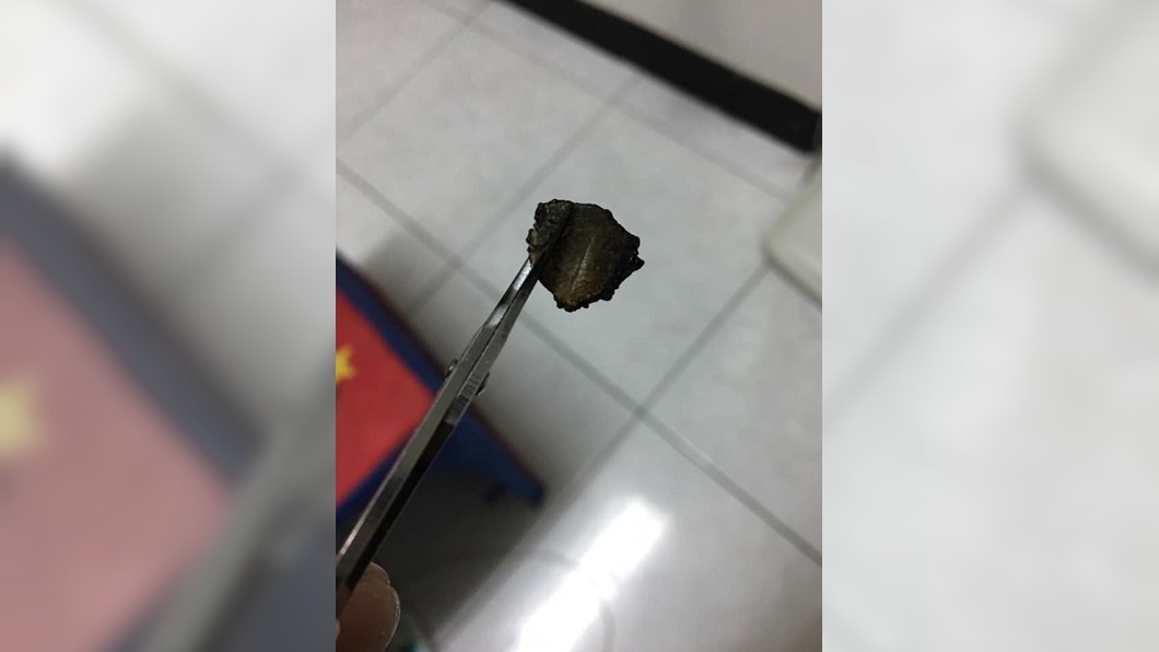 「神祕黑皮」烤出魷魚味!竟是人體這地方 網友全吐了
