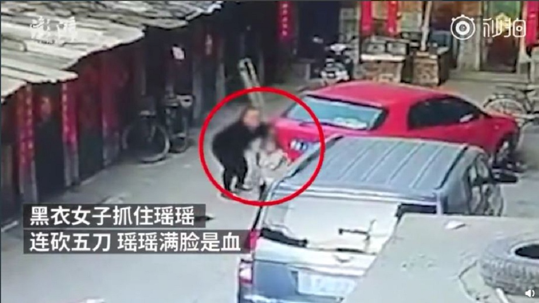女童慘遭精神病患狂砍毀容 哭問母:為何壞阿姨要砍我?