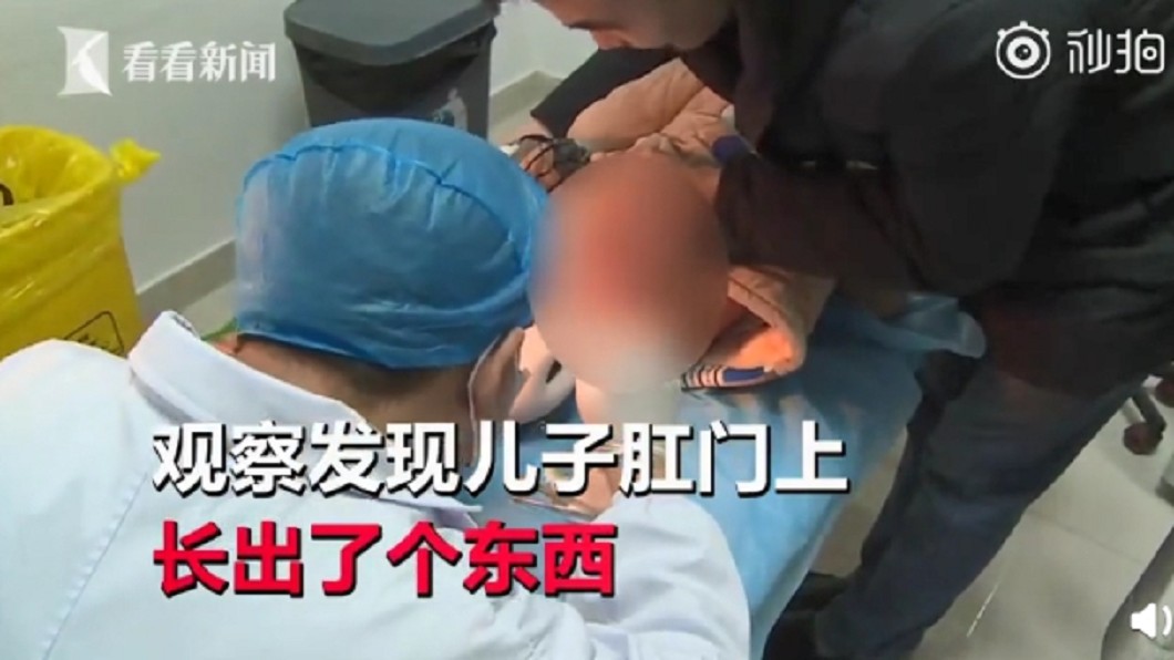 童喊屁股痛!下秒直腸脫垂爆血 醫曝:這食物吃太多