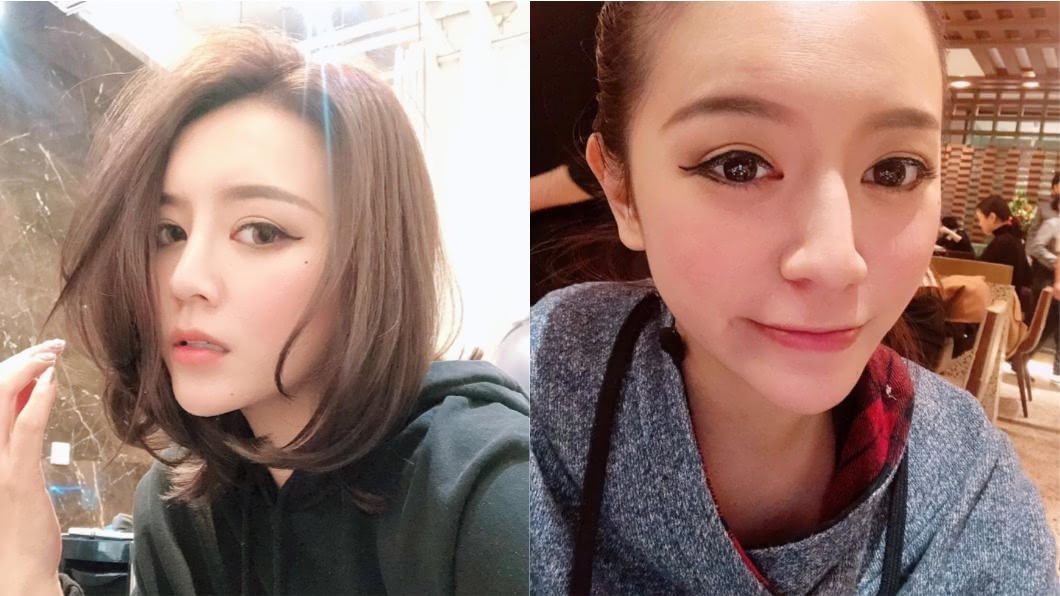 頭禿一大塊!醫師聽完急喊「染性病」 嚇呆女星