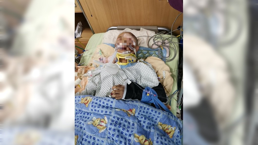 12歲童遭酒駕男「撞飛昏迷」 網友集氣:醒來過兒童節