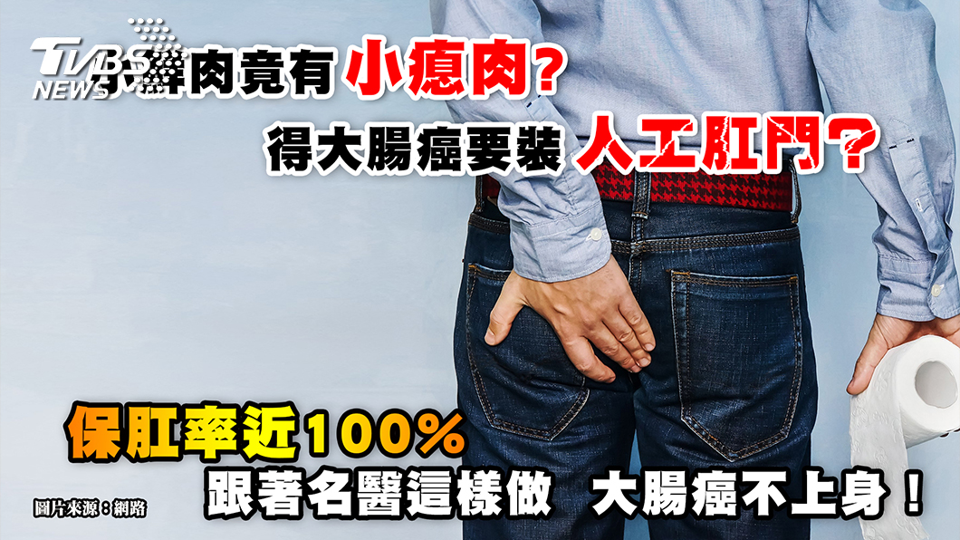 人工肛門 Out!跟著名醫這樣做,大腸癌不上身