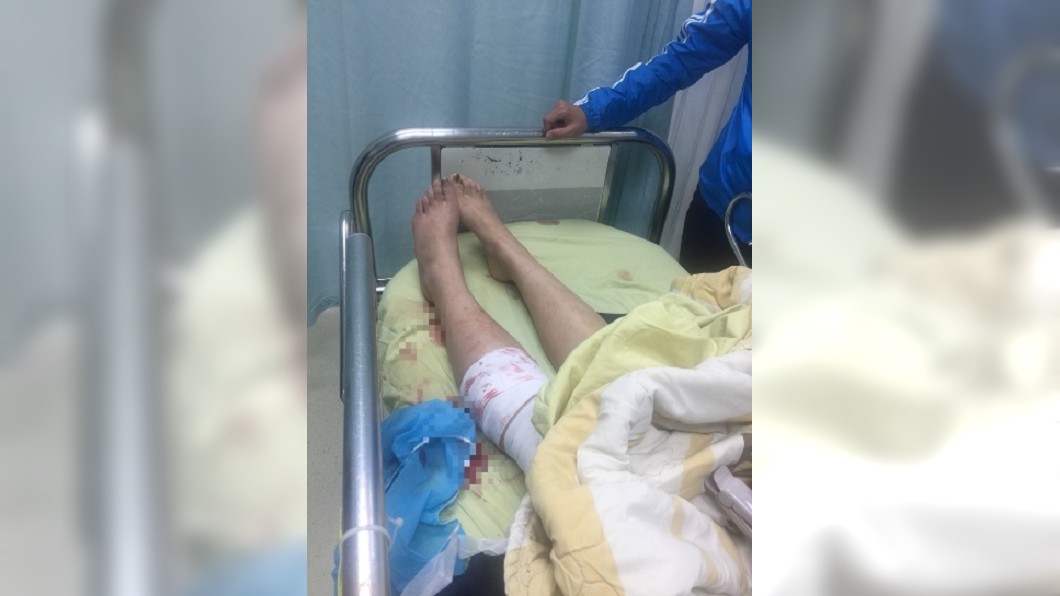 北市女警清槍誤擊自傷小腿　記過2次處分