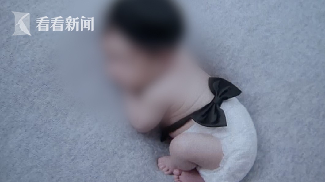 20天大男嬰拍寫真 染上肺炎差點丟命