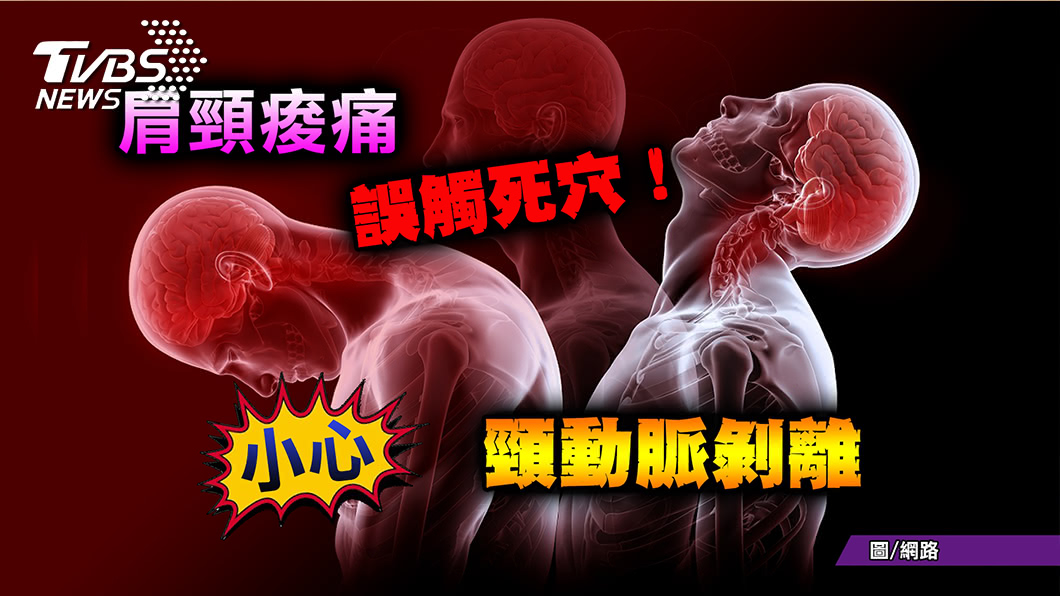 肩頸痠痛抓龍鬆一下 竟然頸動脈剝離!