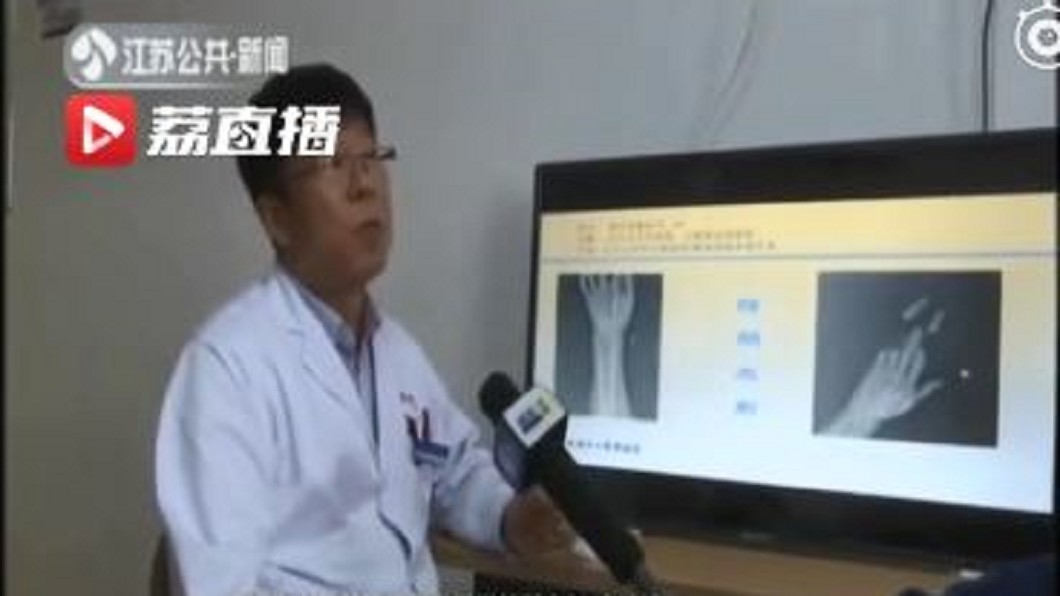 小心「隱形利刃」風箏線 陸男被割斷4手指