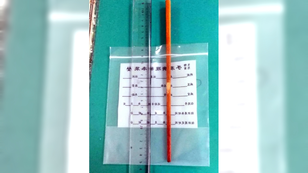 圖/翻攝自中南大學湘雅醫院微博