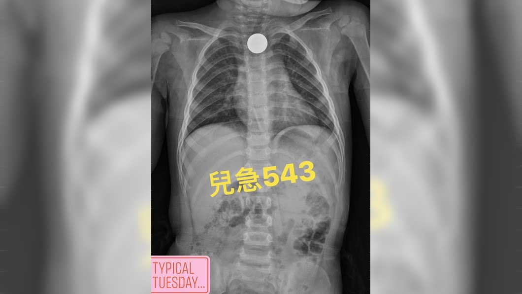 圖/翻攝自來講兒科急診的543-吳昌騰醫師臉書粉絲頁