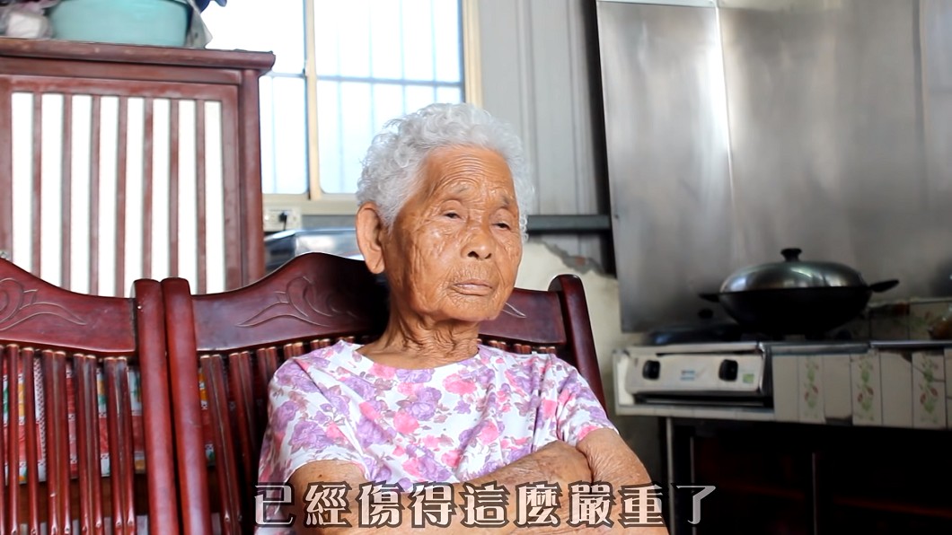 網紅嬤脊椎崩塌　淚捶自己「這腿沒用了」