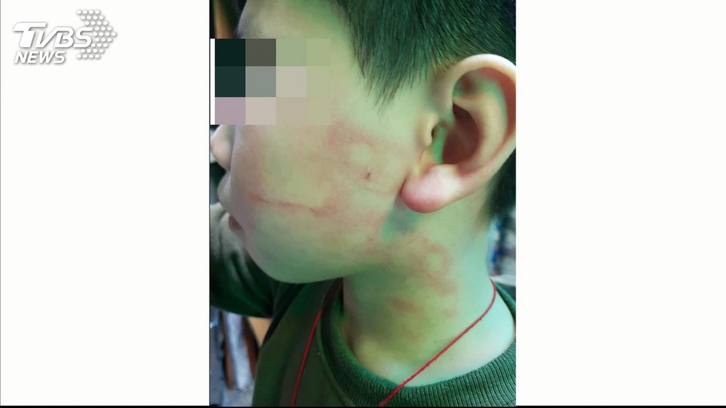 和同學吵架! 小三童遭安親班主任賞巴掌