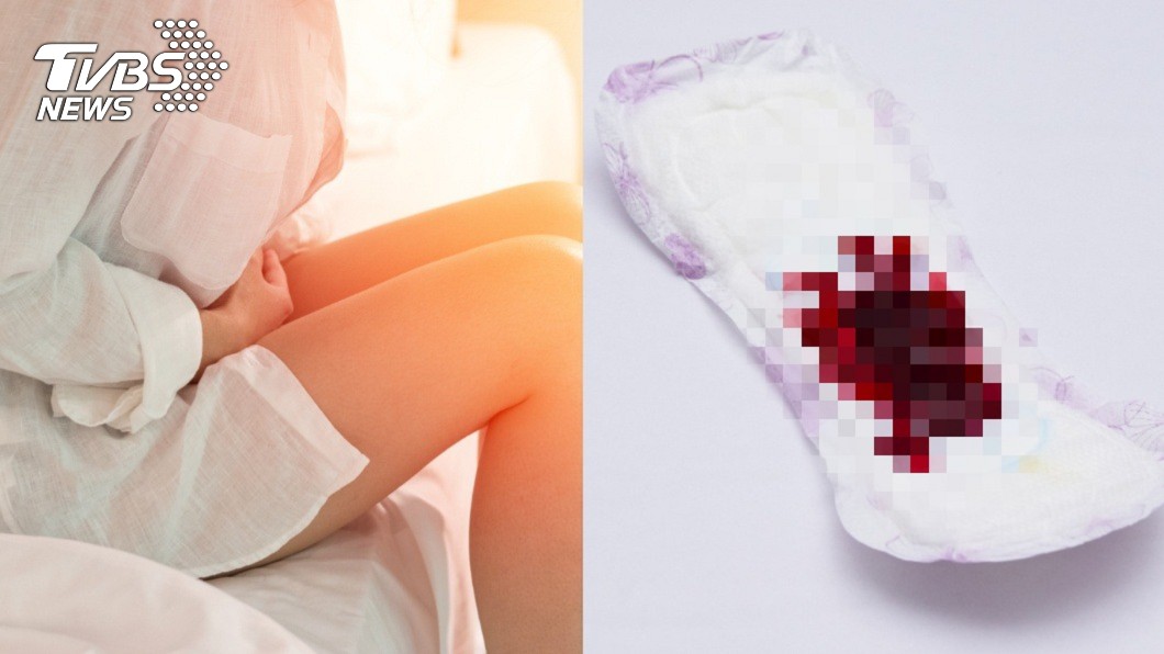 經血暴量!狂掉「燒仙草血塊」 22歲女就醫才知患血癌