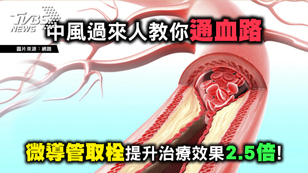 有「臨微不亂」症狀快就醫 中風也可以神復原!