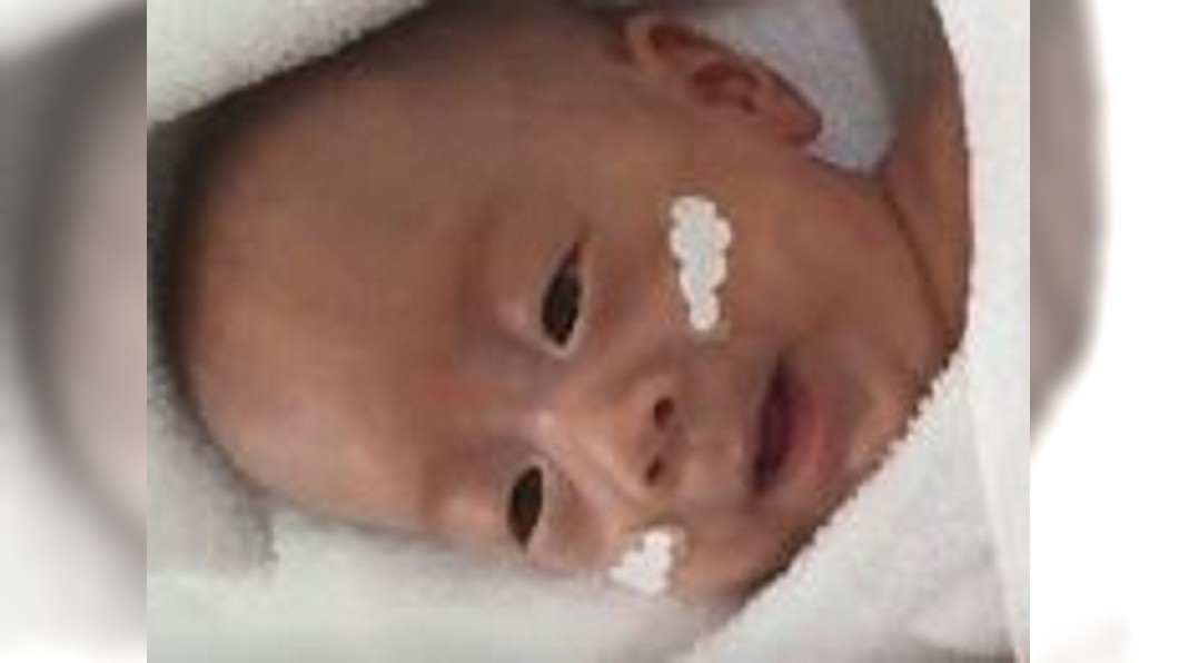出生僅258g! 全球最輕男嬰今健康出院