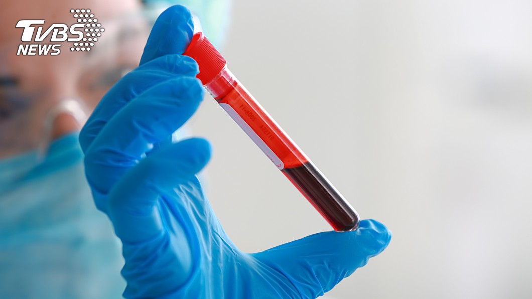 情侶因好玩驗DNA　她見男友「驚人血脈」秒提分手