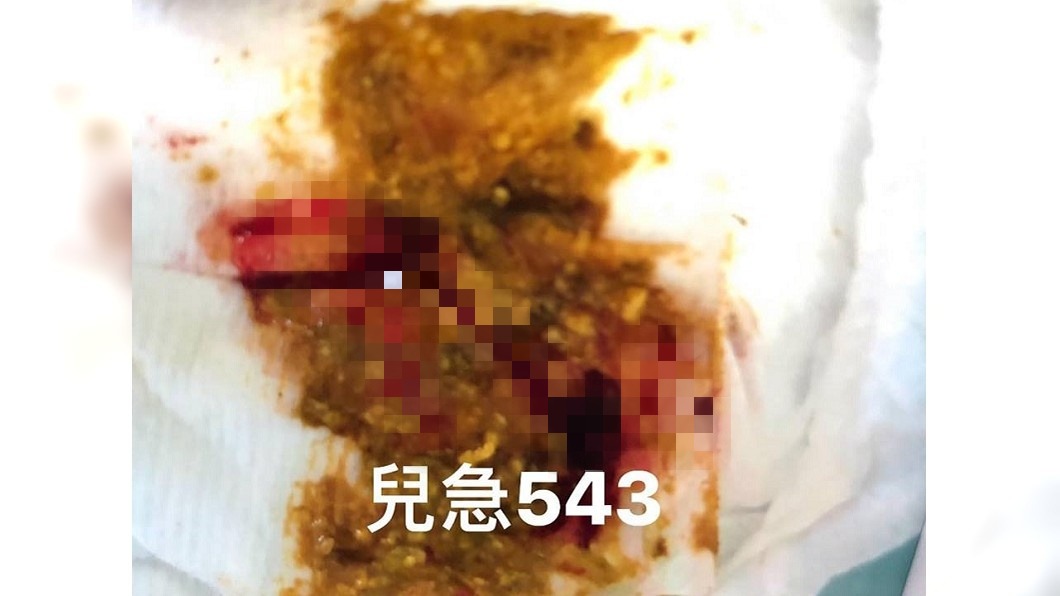換尿布驚見「果醬狀血便」…急送醫 3月男嬰險腸壞死