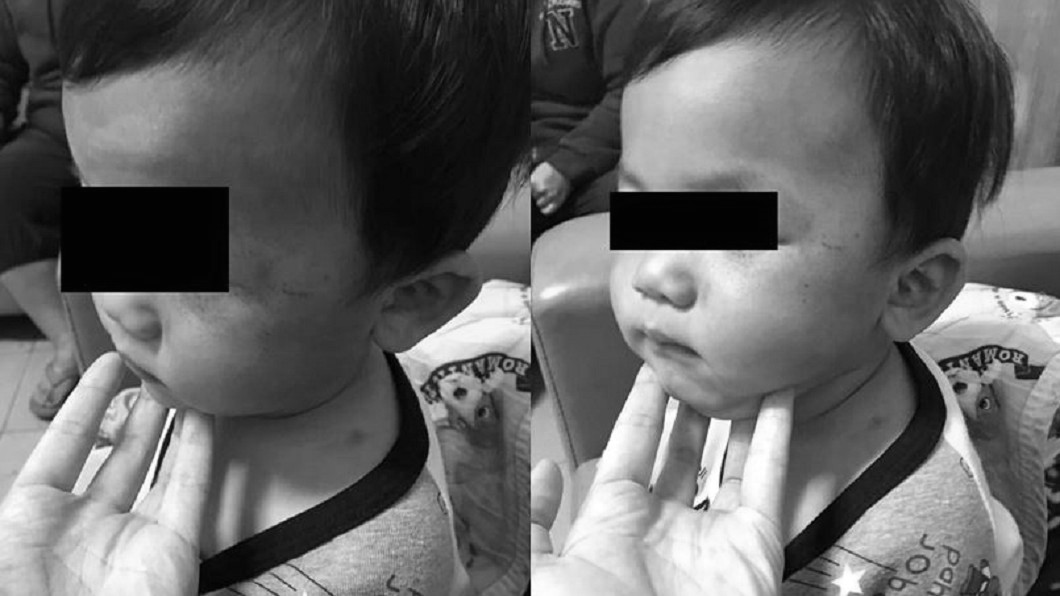 不爽午睡被吵!狠父失控痛毆幼子 媽媽心碎