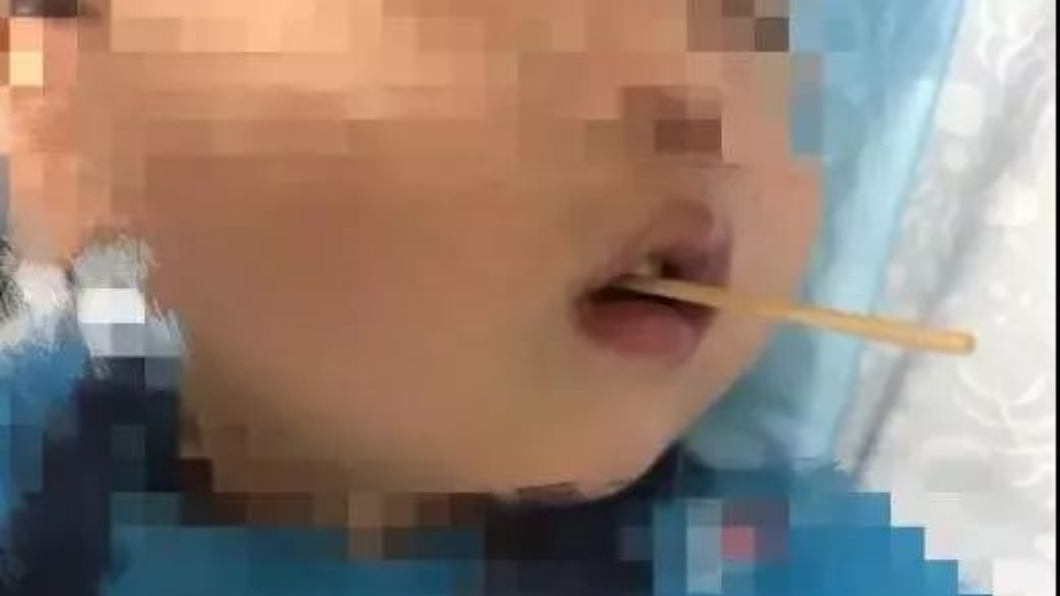 3歲童吃熱狗不慎跌倒!竹籤「穿喉插腦幹」3公分險奪命