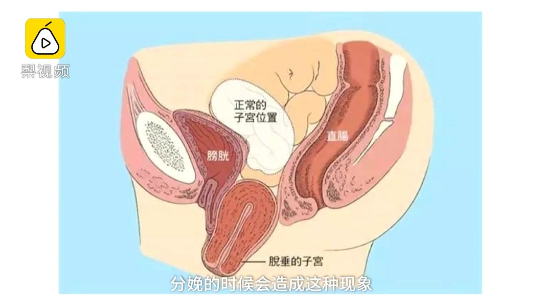 圖/翻攝自梨視頻