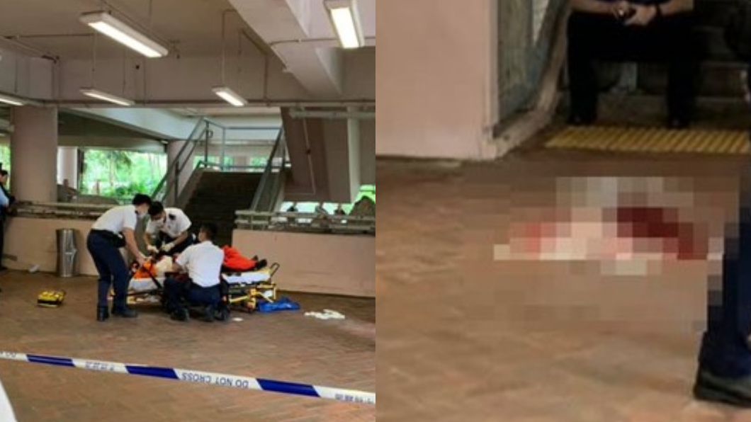 不滿被戴綠帽！夫怒拿剪刀插妻臉　「血肉模糊」路人嚇壞
