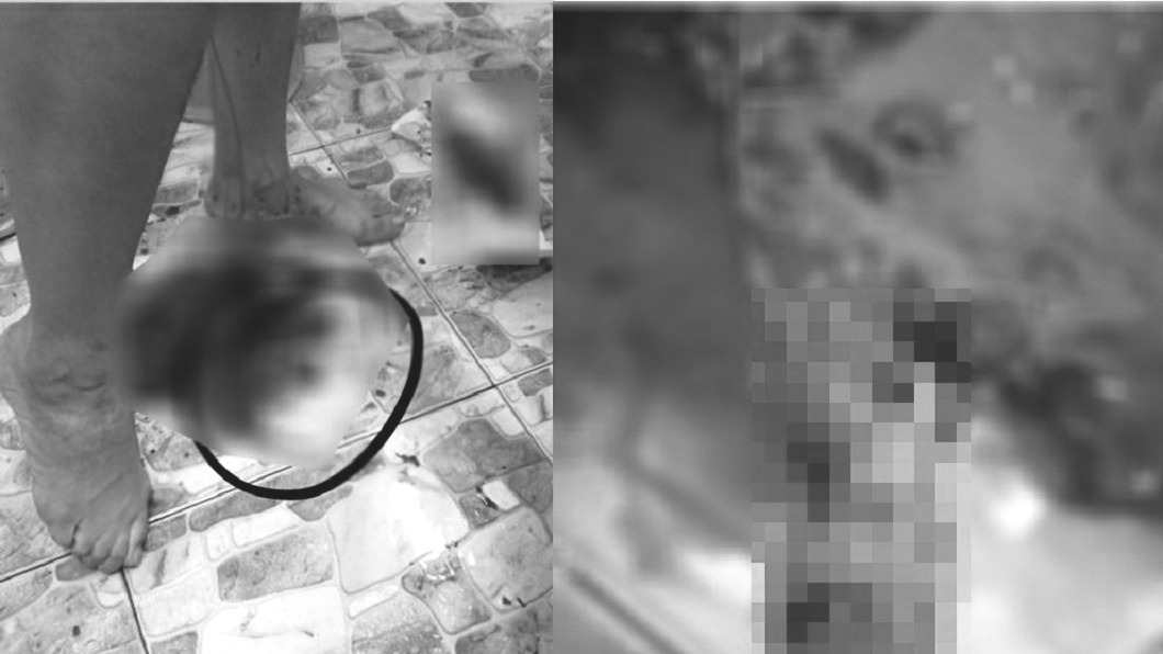 夫缺錢爆打孕妻 胎兒直接從「子宮滑出」慘死