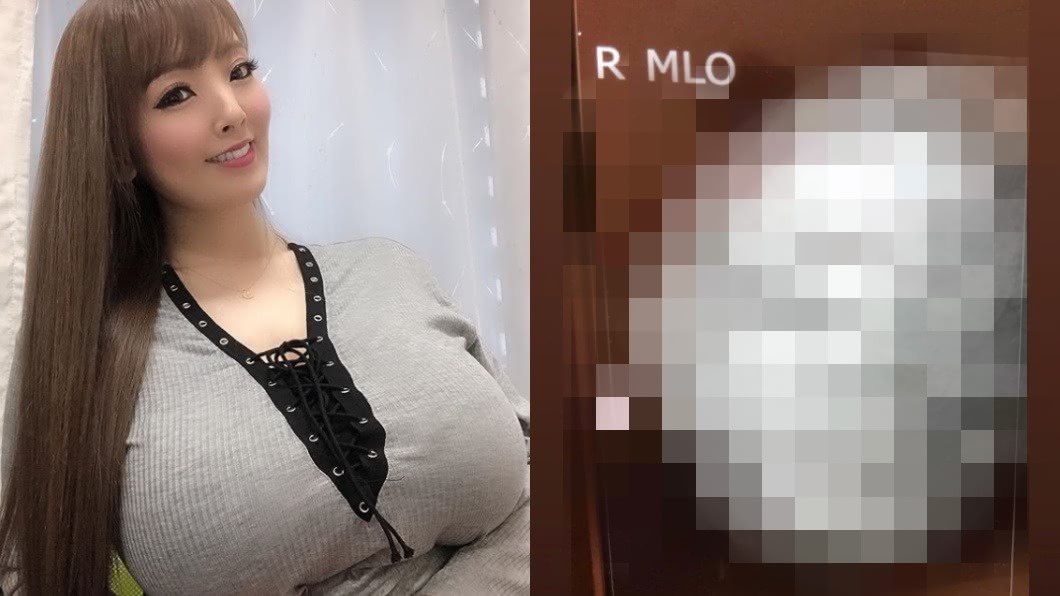 女優狂遭轟隆乳! 暴怒曝這張「透視圖」打臉網友