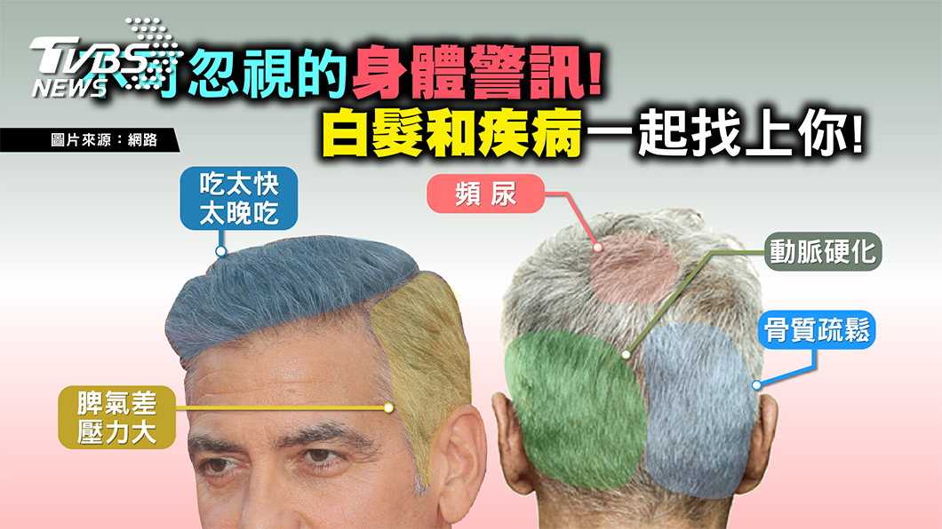 當白髮出現 小心是動脈硬化、骨鬆找上門!