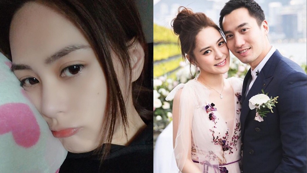爆分居醫生尪「婚結得不值」?阿嬌深夜揭婚姻狀況