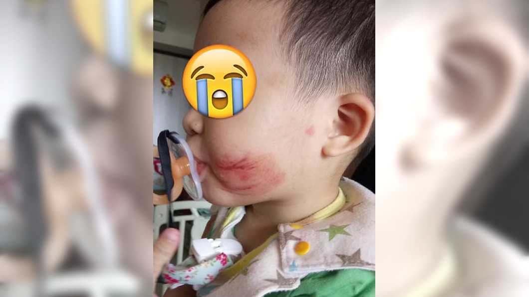 又傳保母虐嬰！膠帶封嘴、滿臉血痕　父母控訴：多麽殘忍