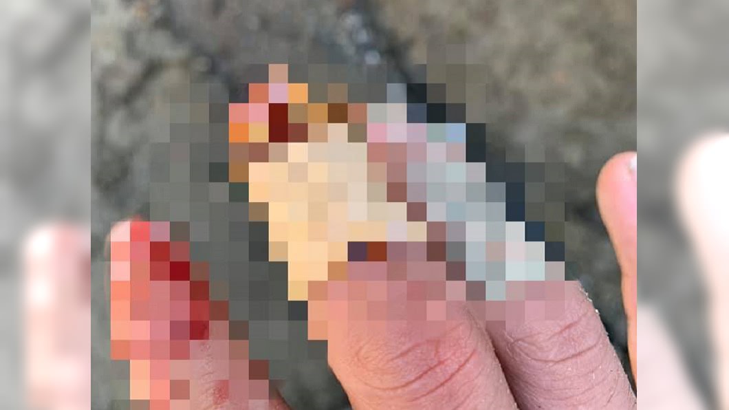 工地受傷老師傅都用這止血 醫傻眼:母湯!