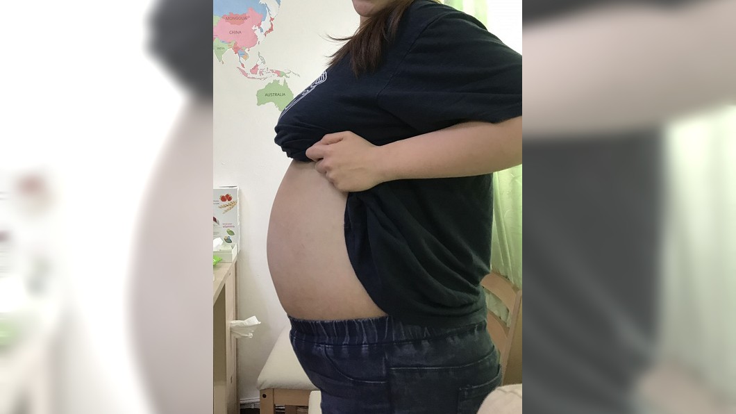 努力減肥肚子仍消不下去 女肚藏16公斤水瘤