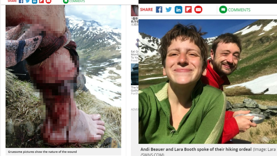 登山遇到熊!男「肉被撕爛」腿骨慘斷 女友靠這招救他命