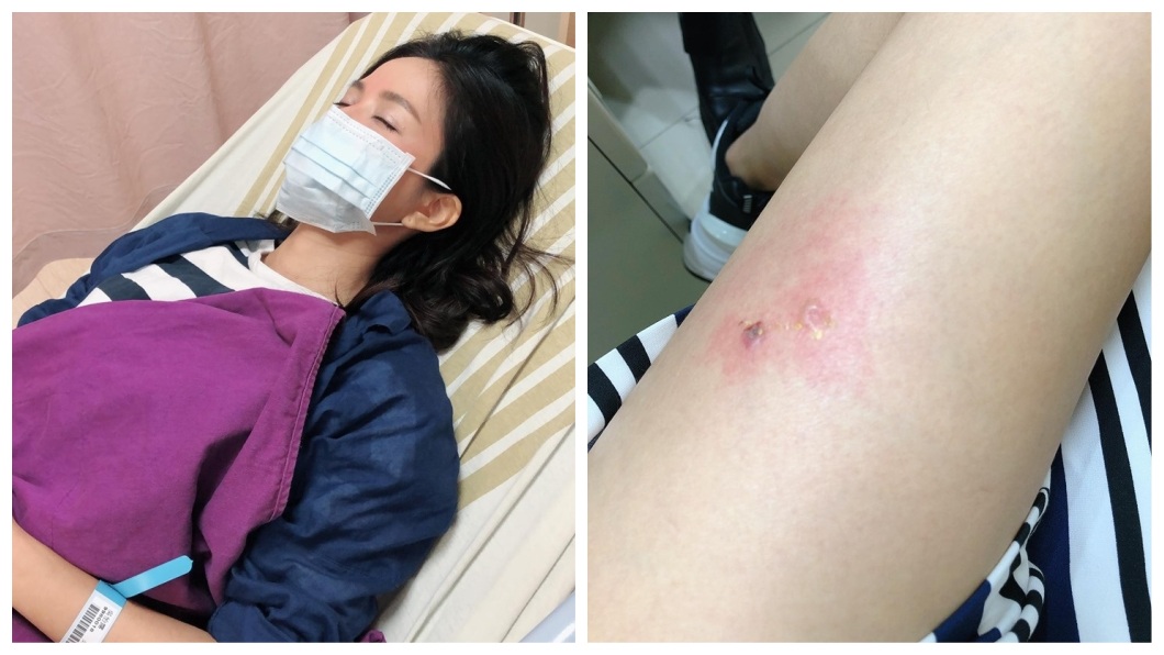 首度擔女一！得A流還被蟲咬　吳怡霈苦撐：不想拖累進度
