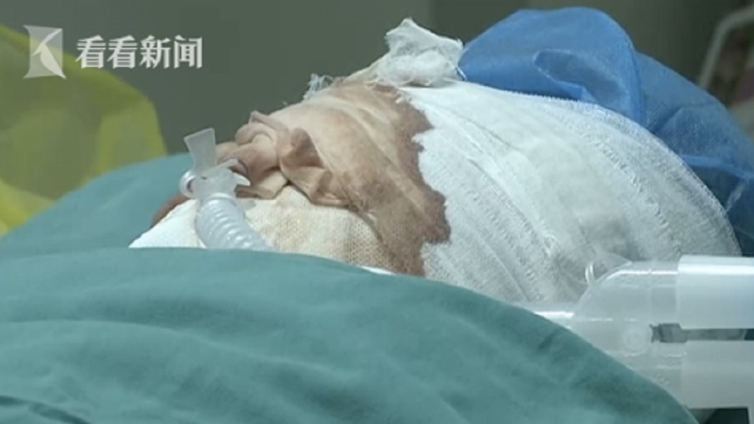 她開心坐副駕出遊　下秒整張臉被不明物「砸凹」毀容失明